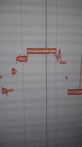 I'm dying #adele #easyonme #autotune