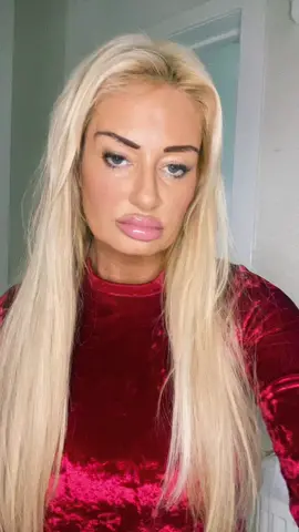#fyp#dugheedarmy #dugheed #scottishtiktok