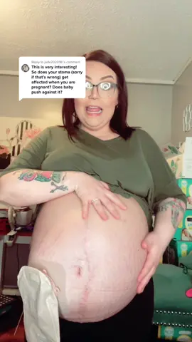 Reply to @jade202018 11 more days! #pregnancy #fyp #colostomy #poopbag