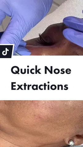 #esthetician #estheticianlife #SmoothLikeNitroPepsi #estheticiantiktok #esthetics