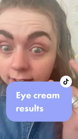 Unexpected but I'm not complaining 🤷‍♀️ #eyecream #undereyecream #undereyes