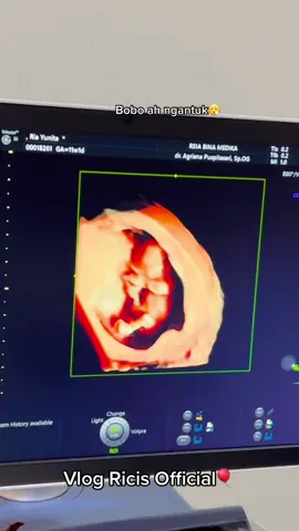 Gitu dong bu, akunya diposting 😰 mau ketemu aunty uncle onlen juga… @teukuryantr 😍 vlog Ricis Official.