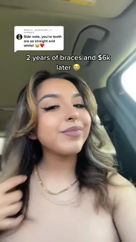 Reply to @_asstomouth_ thank you I used to be super insecure about my teeth😭♥️ #fyp #parati #latina #houston