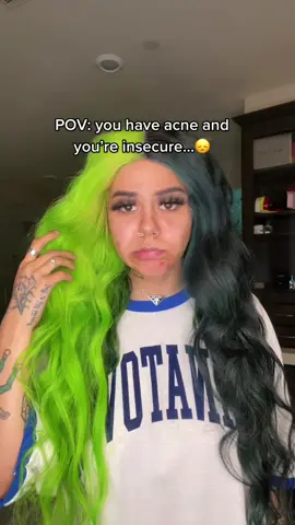 It’s normal 🥰 #sarcus #acne #insecure #perfect #yourebeautifuljustthewayyouare #acneskin #acneisnormal #acneisbeautiful