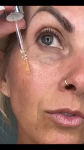 Real skin always wins! Natural skincare + high quality makeup! 💛 #realskin #glowingskin #glowingmakeup #glowingskincare #nofilter #filterfree #naturalbeauty #realskinchallenge #realskintexture #limelifebyalcone