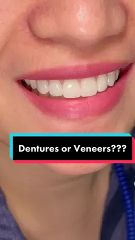 Same person but different smile 😀❤️ Our natural looking ivocap full denture! #drsarahdentalclinic #dentist #malolosbulacan #drsarah #denture #veneers #fyp