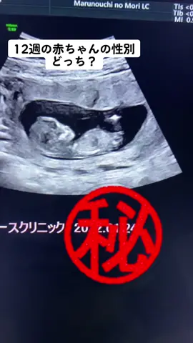 12週で赤ちゃんの性別が判明#丸の内の森レディースクリニック #出生前検査 #胎児エコー #マタニティライフ #赤ちゃん #お腹の赤ちゃん