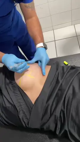 Sígueme para más video y comparte 💉👨‍⚕️🇲🇽🥰@romimarcos #sigueme #Pregunta #enfermeria #enfermeríatiktok  #enfermeria💉💊 #MercadoLibreLooks #enfermeriacomunitaria #enfermeriachallenge #enfermeriaviral #enfermeriahumor #enfermeriaesmipasion #siguemeMercadoLibreLooks #sutura #suturas #tiktok #viral #viraltiktok #VPV @jbalvin @akamztwenty20 @angelaaguilar_ @badbunny