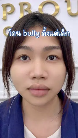 อดทนเก็บเงินเพื่อลบคำบูลลี่ที่โดนมาตั้งแต่เด็ก 👍🏻💗 #ปากกระจับ #ปากกระจับปีกนางฟ้า #หมออาร์มบีพราวด์คลินิก #หน้าตาที่เปลี่ยนไป #เกินต้านchallenge