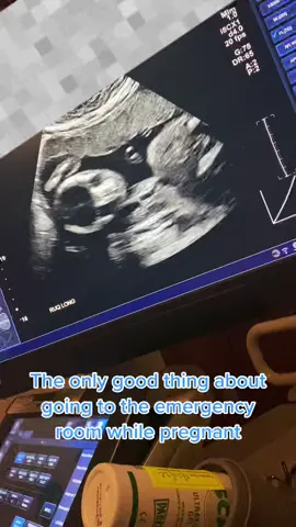 Mommy & Baby are okay💙 I just had to share this precious ultrasound clip #pregnancytiktok #newmom #Totinos425 #onlyinmycalvins #baby