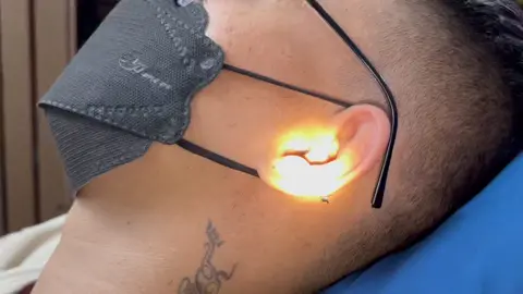 Ngứa hay không nè?#earwaxremnoval #layraytai #layraytaicucphe #earwax #ear #layray #hairmencuts #hairmencuts