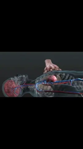 Pertolongan pertama yang cepat dan tepat serta sangat diperlukan dalam kondisi tersebut adalah teknik resusitasi jantung paru (RJP) atau cardiopulmonary resuscitation (CPR). #cpr #rjp #hentijantung