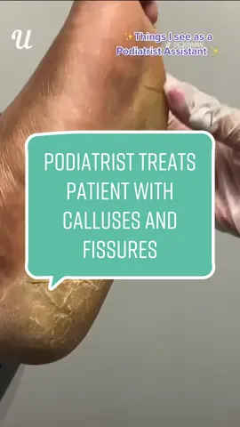 Why you should never get a pedicure if you’re experiencing serious skin issues! (@De’Jon Smith, CMNT 👣💜) #skincare #pedicure #footcare #podiatry #podiatrist #fyp #foryoupage