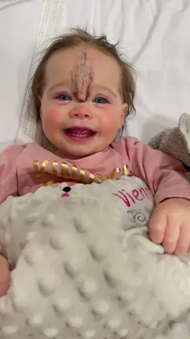 Out strong girl! Crazy how her birthmark changed and grew 1 surgery down 2 to go #fyp #fypage #fypシ゚viral #viral #viraltiktok #surgeon #cmn #birthmarkbaby #raisingawareness #viral #daughter