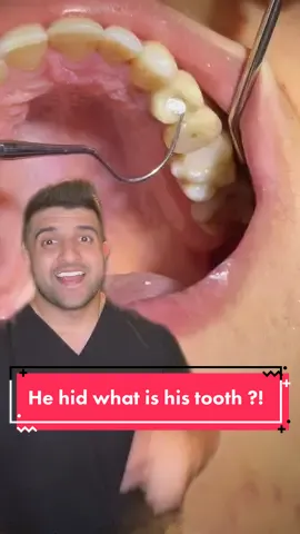 #dentist #learnontiktol #health #gums #didyouknow #facts #nhs #teethwhitening #invisalign #healthylifestyle #health #healthtips #dental #dentalhygienist #dentalhygiene #tartar #dentalcleaning #implant #healthy @Dr. Vincenzo De Luca