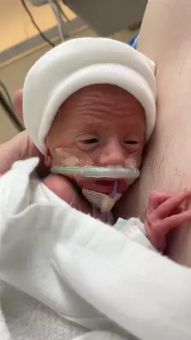 Our miracle baby #28weeker #preemie #MomsofTikTok #thenvsnow #fyp #TopGunMode