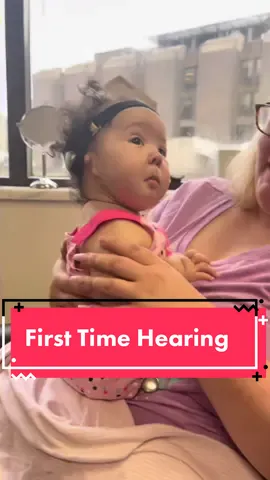 Our 5 month old Amaya hearing for the first time! So so excited!!! #BAHA #hearingaid #specialneeds #microtia #nolegsnolimits #fyp #foryou