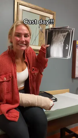 Cast day! So excited to get this splint off 😭