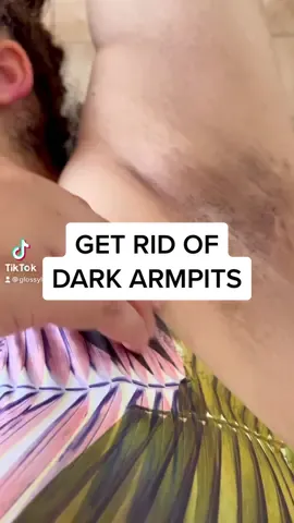 We’re rocking bright skin all summer baby 🐚☀️🌴 link in bio use code TRULYKB27 #trulybeauty #trulybeautypartner #trulybeautytiktokchallenge #bodycareproducts #hyperpigmentationtips #armpithygeine #bodycaretiktok #darkarmpits