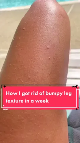 How I got rid of bumpy leg texture in a week 🫶🏻 #bumpyleg #cloggedpores #skintok #beauty @drunkelephant @CeraVe