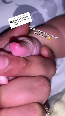 Reply to @bethanievera ugh i feel so bad for her I wish it wasn’t that much thumb sad🥺#fyp #viral #MomsofTikTok #babiesoftiktok #baby#haters #thunb