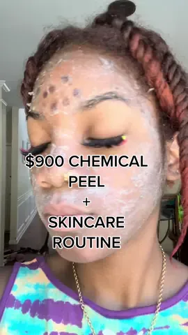 DAY 6 of my Chemical Peel AND my skincare routine for the next month🙂 My Face is feeling pretty good and my chin is doing better💕.             #skincare #skintok #acne  #chemicalpeel #foryou #skincareroutine #melanxpeel #oilyskin #fyp