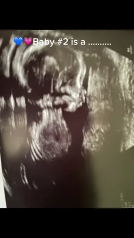 @deveonnewby #momtok #fyp #CheetosReaperReactions #foryou #foryoupage #baby #babiesoftiktok #boymom #MomsofTikTok #momlife #gerber #gerberbaby #2under2 #pregnancy #2 #genderreveal #boyorgirl #genderrevealparty