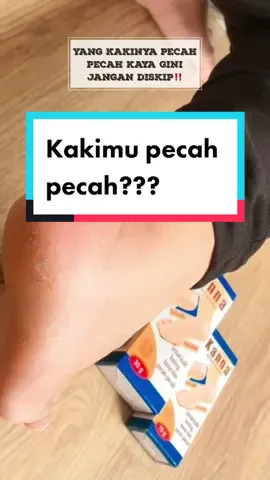 Yang kakinya pecah” jangan skippp🥵#RahasiaGlowing #ResepGlowUp #najmiabeauty #tiktokbeautyunboxing #kannacream #kannasoftcream #SahabatKanna #AntiTumitKering #perawatankaki