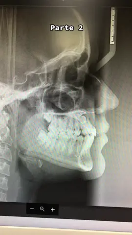 #dentist #radiografia #dentista #fyp #tiktok #fyp