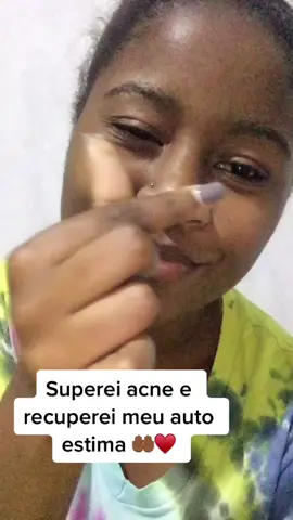#mocambiquetiktok🇲🇿 #viralvideo #acne #insegurançascomocorpo nao foi facil falar disso, mas enfim, caso queiram que eu conte e mostre fotos de como foi o tratamento é so comentar e eu faço outro video