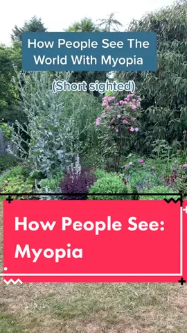Representation of Myopia #myopia #vision #eyes #LearnOnTikTok #shortsighted #nearsighted