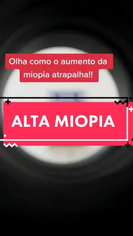 Veja a miopia desde o grau “baixo” até o “alto”| ✅ME SIGA PARA VER MAIS VIDEOS COMO ESSE, e comente qual vídeo quer ve aqui ⤵️ #miopia #miopiaalta #coisasdemiope #miopiachallenge #optometria #examedevista