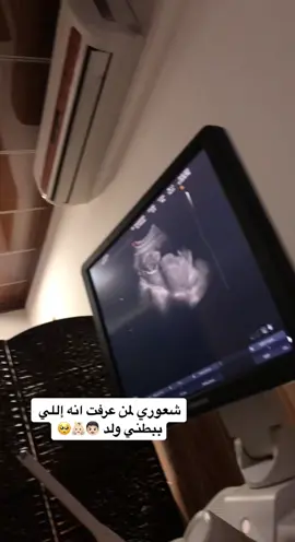 باي شهر عرفتوا جنس الجنينكم 🥰 ؟ #سونار #جنين #طفل #حملي #ولد 2022/4/6