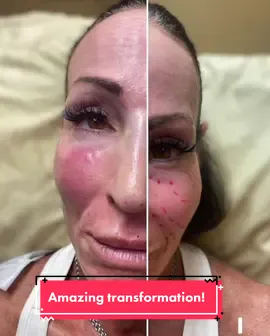 #plasticsurgeon #makeover #beautiful #beforeafter #facereveal #cosmeticsurgerytiktok #cosmeticsurgery