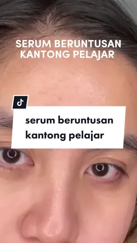 serum beruntusan low budget tapiii hasilnya 🫶🫶🫶 #serum #serumjerawat #theoriginote 