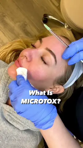Did you know you could use Botox for this? #botoxhacks #dallasinjector #skinsecretskinfluencer #33333 #fyp