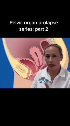 What actually causes a pelvic organ prolapse?? #pregnancytiktok #pregnancy #constipation #prolapse #prolapsetok #pelvichealth #fyp #foryou #trending #mumsoftiktok