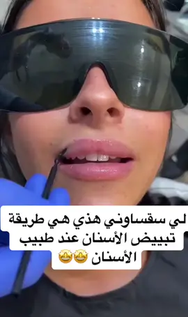 تبييض الأسنان  blanchiment dentaire 🤩🤩 #khabylame #follow #viral #dentist #dz #wahran #oran #alger