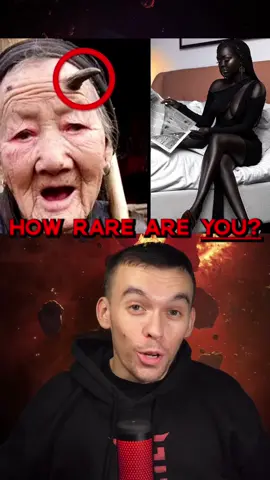 👽How Rare Are You? (Wait for it..) #anatomy #facts #body #human #tiktokhunter #mtl #khieu 🥷