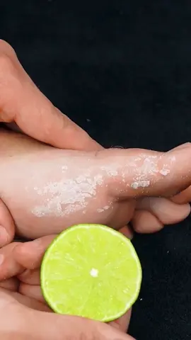 Goodbye dry feet! 😍 #feet #skincare #LearnOnTikTok #fyp #fypシ