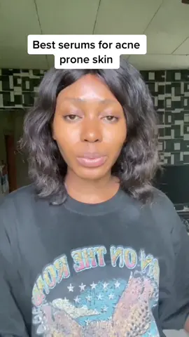 @anitaeguono Lost your confidence due to having acne & hyperpigmentation? Click the link in my bio to book a consultation (paid) to get clear skin, become confident & happy again!  #acneproneskin #acneproneskincare #hyperpigmentationserum #facetheoryskincare #drrashelfaceserum #cosrxdermserum