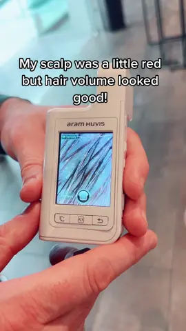 Follow me for more beauty finds 🤍 #hairtok #hairhealth #scalphealth #scalpcheck #hairhealthtips 