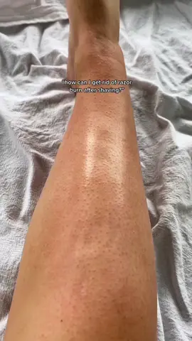 Simple as #shaving #shavingtips #skincare #hairremoval #sustainableshaving #ecoshaving #safetyrazor #ecorazor #nz #australia #shavinghacks #razorburn #strawberrylegs