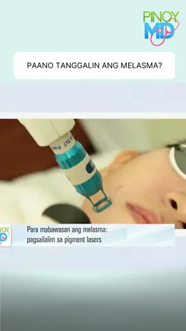 Paano tanggalin ang melasma? #PinoyMD #NewsPH #SocialNewsPH #Health