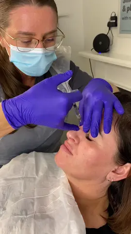 Non-Surgical Rhinoplasty results are the best 🤌🏼 #nonsurgicalrhinoplasty #nonsurgicalnosejob #aestheticclinic 