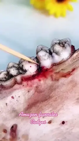 dental irrigator#DrPepperTuitionContest #amazonfinds #amazonfavorites #PartyWithVMAs #ChewTheVibes #MessFreeHero #ShowOffLandOFrost #ReTokforNature #amazonfashion #WorldPrincessWeek #FilmTeyvatIslands #tiktok2022 #amazonvirtualtryon #AEJeansSoundOn #amazon #amazonas #fyp #fourpeopeo