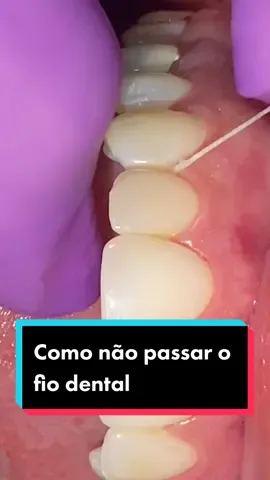 Me conta, você já passou o fio dental dessa forma? 😅 #prevenção #saudebucal #fiodental #fiodentaltododia #prevencaobucal 