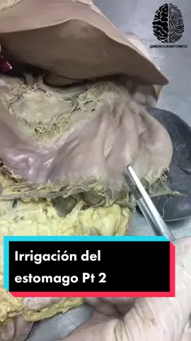 irrigación de la curvatura mayor del estómago #anatomia #for #foryou #parati #foryoupage #med #medicina #dr #cirugia #peso #estomago 