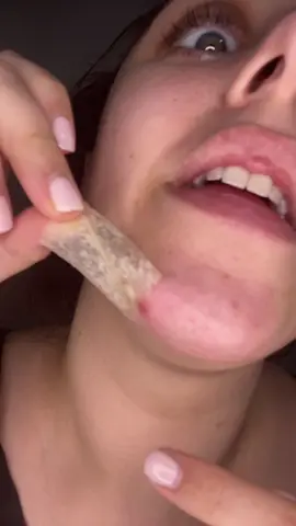 #herocosmetics #heropatches #heropimplepatch #squeezingpimples #squeezepimples #pimplesqueeze #pimplepatch #pimplepatches #pimplepatchremoval #pimplepatchpeel #mightypatch #mightypatches #mightypatchface #mightpatchnose #heromightypatch #heromightypatchs #simplepimplepatch #pimplepopping #poppingpimple #acnepatches #acnepatch #acnetreatment #acne #pimplepatchresults #heropatch #heropatches #daraj 
