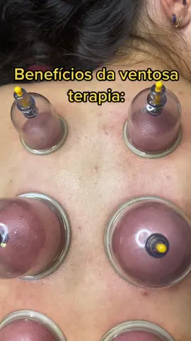#ventosaterapia #fypシ #viral #vaiprofycaramba 